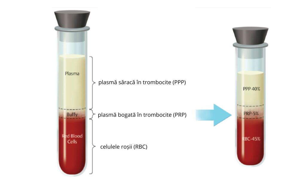 eprubeta plasma si celule rosii