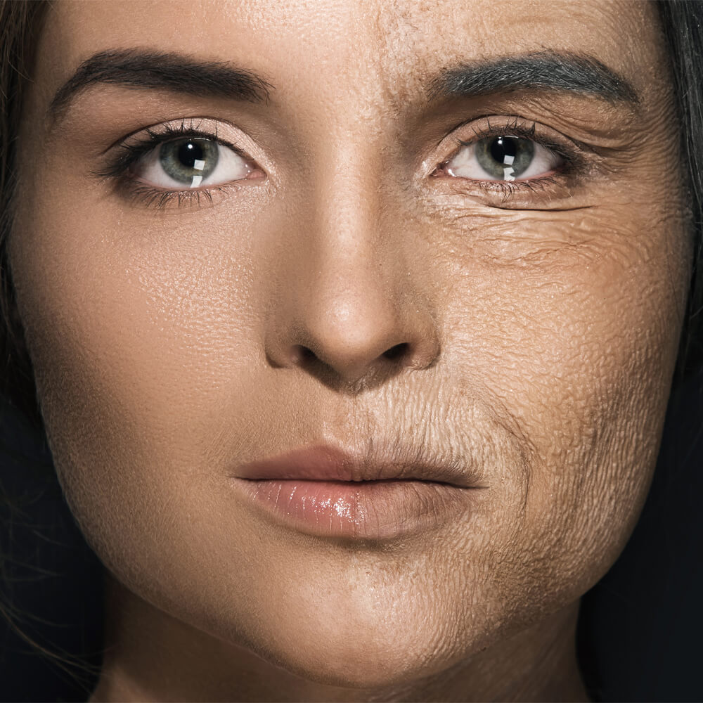 Tratamente Anti-Îmbătrânire cu Botox