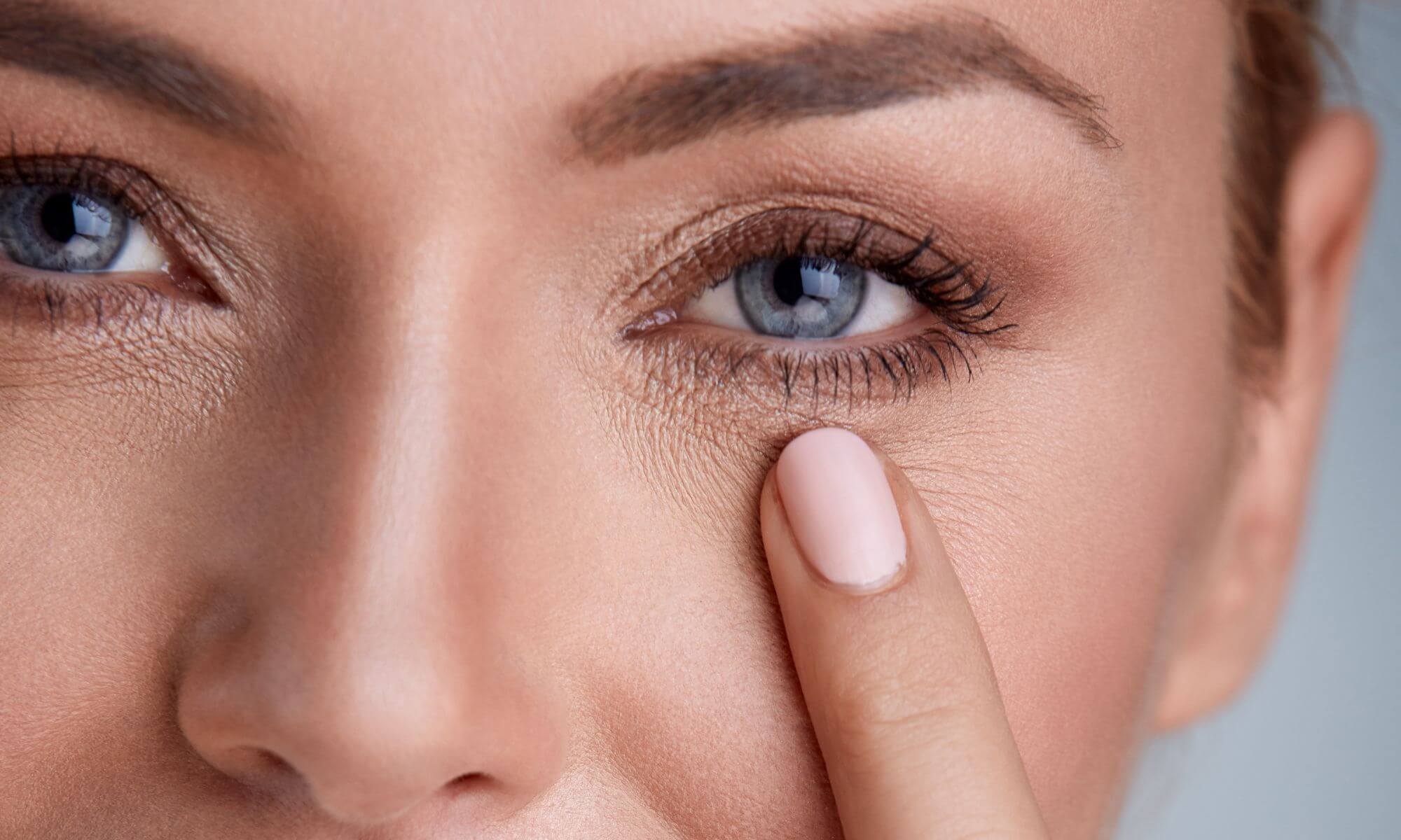 3 tipuri de tratament utile pentru riduri la ochi în 2022