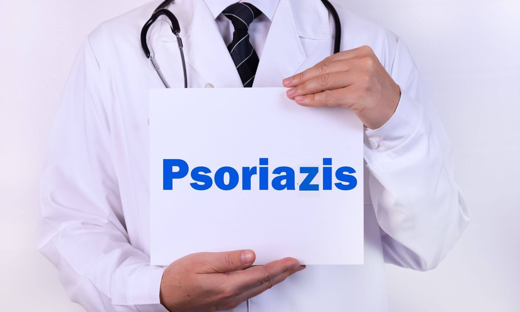 Cele mai critice sfaturi medicale când suferi de psoriazis