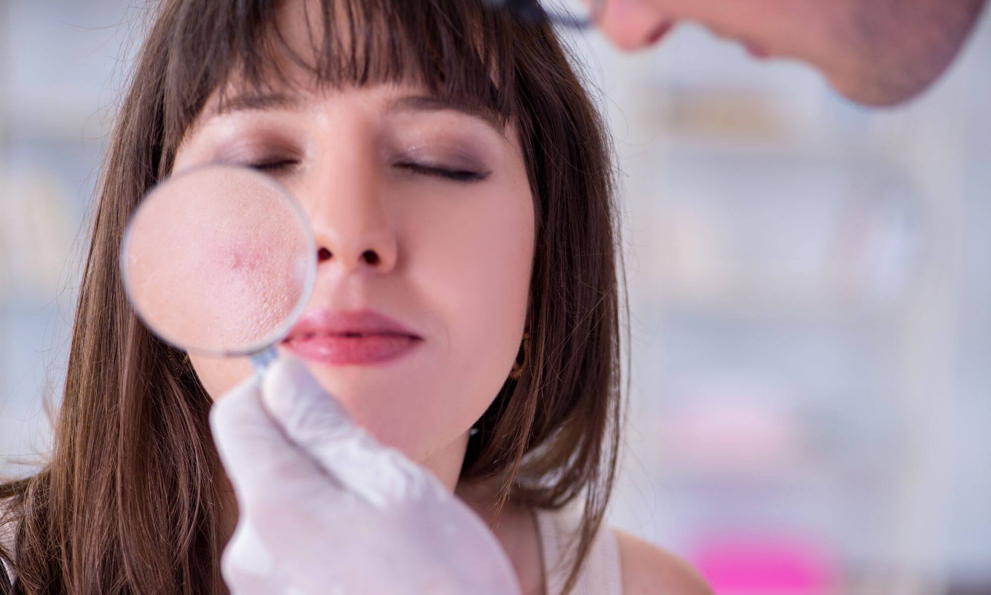 îngrijire a tenului cu acnee rozacee, recomandate de orice medic dermatolog