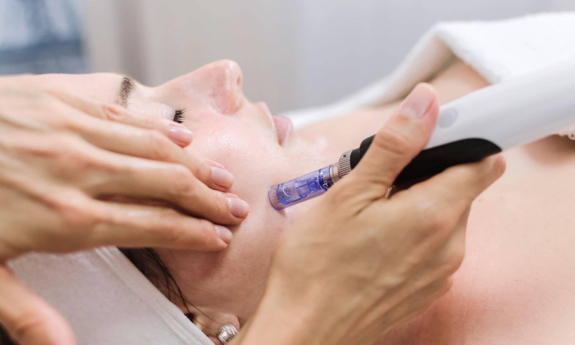 Tipuri de tratament pentru pori dilatați recomandate de dermatologi