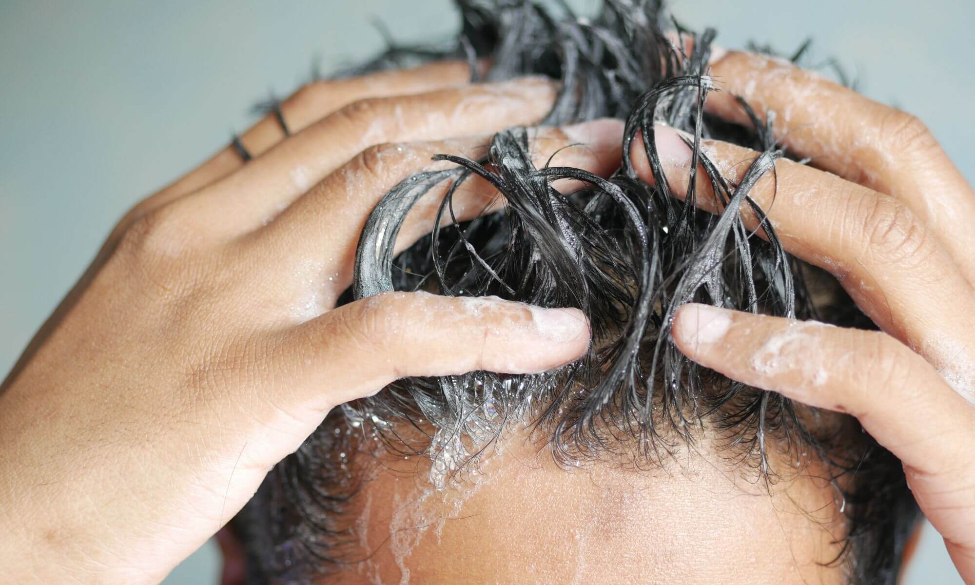 Ce să eviți dacă ai o iritație pe scalp