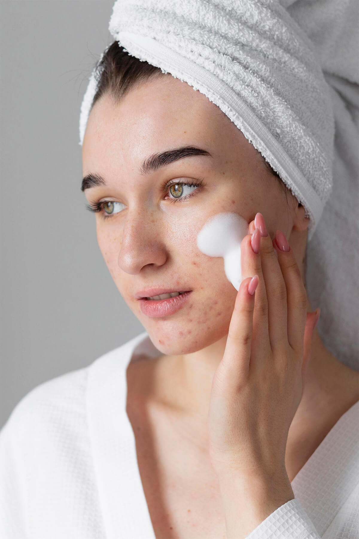 Cum poți să previi acneea